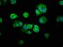 Immunofluorescence staining of MCF-7 cells with CAC14122 at 1:250, counter-stained with DAPI. The cells were fixed in 4% formaldehyde, permeabilized using 0.2% Triton X-100 and blocked in 10% normal Goat Serum. The cells were then incubated with the antibody overnight at 4°C. The secondary antibody was Alexa Fluor 488-congugated AffiniPure Goat Anti-Rabbit IgG(H+L).