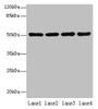 Western Blot, All lanes: CEACAM1 antibody at 10ug/ml, Lane 1: HT29 whole cell lysate, Lane 2: HCT116 whole cell lysate, Lane 3: COLO205 whole cell lysate, Lane 4: HepG2 whole cell lysate, Secondary, Goat polyclonal to rabbit IgG at 1/10000 dilution, Predicted band size: 58, 46, 36, 39, 51, 47, 28, 44, 52, 40 kDa, Observed band size: 51 kDa