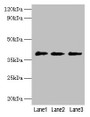 Western Blot, All lanes: POU5F1 antibody at 2ug/ml, Lane 1: Jurkat whole cell lysate, Lane 2: Hela whole cell lysate, Lane 3: 293T whole cell lysate, Secondary, Goat polyclonal to rabbit IgG at 1/10000 dilution, Predicted band size: 39, 31 kDa, Observed band size: 39 kDa