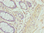 Immunohistochemistry of paraffin-embedded human colon tissue using CAC14133 at dilution of 1:100
