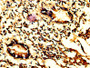 IHC image of CAC14141 diluted at 1:200 and staining in paraffin-embedded human appendix tissue performed on a Leica BondTM system. After dewaxing and hydration, antigen retrieval was mediated by high pressure in a citrate buffer (pH 6.0). Section was blocked with 10% normal goat serum 30min at RT. Then primary antibody (1% BSA) was incubated at 4°C overnight. The primary is detected by a biotinylated secondary antibody and visualized using an HRP conjugated SP system.