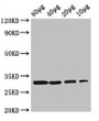 Western Blot, Positive WB detected in: Rosseta bacteria lysate at 80ug, 40ug, 20ug, 10ug, All lanes: rbsK antibody at 3ug/ml, Secondary, Goat polyclonal to rabbit IgG at 1/50000 dilution, Predicted band size: 33 kDa, Observed band size: 33 kDa