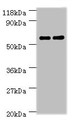 Western Blot, All lanes: Ces1c antibody at 2ug/ml, Lane 1: Mouse liver tissue, Lane 2: Rat liver tissue, Secondary, Goat polyclonal to rabbit IgG at 1/10000 dilution, Predicted band size: 62 kDa, Observed band size: 62 kDa