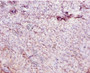 Immunohistochemistry of paraffin-embedded human tonsil tissue using CAC14157 at dilution of 1:10