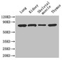 Western Blot, Positive WB detected in: Mouse lung tissue, Mouse kidney tissue, Mouse skeletal muscle tissue, Mouse thymus tissue, All lanes: Ces1c antibody at 4ug/ml, Secondary, Goat polyclonal to rabbit IgG at 1/50000 dilution, Predicted band size: 62 kDa, Observed band size: 62 kDa