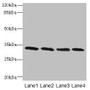 Western Blot, All lanes: PNP antibody at 16ug/ml, Lane 1: Jurkat whole cell lysate, Lane 2: K562 whole cell lysate, Lane 3: U937 whole cell lysate, Lane 4: 293T whole cell lysate, Secondary, Goat polyclonal to rabbit IgG at 1/10000 dilution, Predicted band size: 33 kDa, Observed band size: 33 kDa