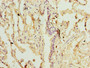 Immunohistochemistry of paraffin-embedded human lung tissue using CAC14162 at dilution of 1:100