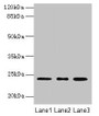 Western Blot, All lanes: MRPL58 antibody at 2ug/ml, Lane 1: A549 whole cell lysate, Lane 2: Jurkat whole cell lysate, Lane 3: K562 whole cell lysate, Secondary, Goat polyclonal to rabbit IgG at 1/10000 dilution, Predicted band size: 24 kDa, Observed band size: 24 kDa Western Blot, All lanes: MRPL58 antibody at 2ug/ml, Lane 1: A549 whole cell lysate, Lane 2: Jurkat whole cell lysate, Lane 3: K562 whole cell lysate, Secondary, Goat polyclonal to rabbit IgG at 1/10000 dilution, Predicted band size: 24 kDa, Observed band size: 24 kDa