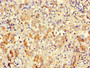 Immunohistochemistry of paraffin-embedded human lung tissue using CAC14165 at dilution of 1:100 Immunohistochemistry of paraffin-embedded human lung tissue using CAC14165 at dilution of 1:100