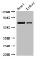 Western Blot, Positive WB detected in: Mouse heart tissue, Mouse kidney tissue, All lanes: ETFDH antibody at 3ug/ml, Secondary, Goat polyclonal to rabbit IgG at 1/50000 dilution, Predicted band size: 69, 63 kDa, Observed band size: 69 kDa