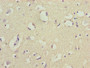 Immunohistochemistry of paraffin-embedded human brain tissue using CAC14182 at dilution of 1:100