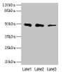 Western Blot, All lanes: ZBTB6 antibody at 8ug/ml, Lane 1: Hela whole cell lysate, Lane 2: HepG2 whole cell lysate, Lane 3: 293T whole cell lysate, Secondary, Goat polyclonal to rabbit IgG at 1/10000 dilution, Predicted band size: 49 kDa, Observed band size: 49 kDa