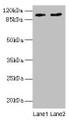 Western Blot, All lanes: CCDC57 antibody at 1.2ug/ml, Lane 1: PC-3 whole cell lysate, Lane 2: HepG2 whole cell lysate, Secondary, Goat polyclonal to rabbit IgG at 1/10000 dilution, Predicted band size: 104, 86 kDa, Observed band size: 104 kDa