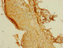 Immunohistochemistry of paraffin-embedded human skin tissue using CAC14198 at dilution of 1:100