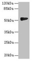 Western Blot, All lanes: GTDC1 antibody at 4ug/ml + A549 whole cell lysate, Secondary, Goat polyclonal to rabbit IgG at 1/10000 dilution, Predicted band size: 53, 44, 34, 50, 38 kDa, Observed band size: 53 kDa