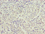 Immunohistochemistry of paraffin-embedded human lung cancer using CAC14212 at dilution of 1:100