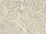 Immunohistochemistry of paraffin-embedded human pancreatic tissue using CAC14214 at dilution of 1:100 Immunohistochemistry of paraffin-embedded human pancreatic tissue using CAC14214 at dilution of 1:100