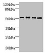 Western Blot, All lanes: TTC38 antibody at 1.5ug/ml, Lane 1: U251 whole cell lysate, Lane 2: Mouse liver tissue, Lane 3: HepG2 whole cell lysate, Lane 4: K562 whole cell lysate, Secondary, Goat polyclonal to rabbit IgG at 1/10000 dilution, Predicted band size: 53 kDa, Observed band size: 53 kDa Western Blot, All lanes: TTC38 antibody at 1.5ug/ml, Lane 1: U251 whole cell lysate, Lane 2: Mouse liver tissue, Lane 3: HepG2 whole cell lysate, Lane 4: K562 whole cell lysate, Secondary, Goat polyclonal to rabbit IgG at 1/10000 dilution, Predicted band size: 53 kDa, Observed band size: 53 kDa