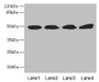 Western Blot, All lanes: TBCEL antibody at 12ug/ml, Lane 1: Rat gonadal tissue, Lane 2: PC-3 whole cell lysate, Lane 3: Rat heart tissue, Lane 4: 293T whole cell lysate, Secondary, Goat polyclonal to rabbit IgG at 1/10000 dilution, Predicted band size: 49 kDa, Observed band size: 49 kDa Western Blot, All lanes: TBCEL antibody at 12ug/ml, Lane 1: Rat gonadal tissue, Lane 2: PC-3 whole cell lysate, Lane 3: Rat heart tissue, Lane 4: 293T whole cell lysate, Secondary, Goat polyclonal to rabbit IgG at 1/10000 dilution, Predicted band size: 49 kDa, Observed band size: 49 kDa