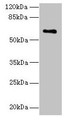 Western Blot, All lanes: CWF19L1 antibody at 4ug/ml + Raji whole cell lysate, Secondary, Goat polyclonal to rabbit IgG at 1/10000 dilution, Predicted band size: 61, 28, 46 kDa, Observed band size: 61 kDa