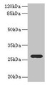 Western Blot, All lanes: TEX35 antibody at 4ug/ml + U251 whole cell lysate, Secondary, Goat polyclonal to rabbit IgG at 1/10000 dilution, Predicted band size: 27, 26, 24, 21, 25 kDa, Observed band size: 27 kDa