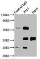 Immunoprecipitating Arg1 in Rat liver tissue, Lane 1: Rabbit control IgG instead of CAC14228 in Rat liver tissue. For western blotting, a HRP-conjugated Protein G antibody was used as the secondary antibody (1/2000), Lane 2: CAC14228 (8ug) + Rat liver tissue (500ug), Lane 3: Rat liver tissue (10ug) Immunoprecipitating Arg1 in Rat liver tissue, Lane 1: Rabbit control IgG instead of CAC14228 in Rat liver tissue. For western blotting, a HRP-conjugated Protein G antibody was used as the secondary antibody (1/2000), Lane 2: CAC14228 (8ug) + Rat liver tissue (500ug), Lane 3: Rat liver tissue (10ug)