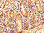 Immunohistochemistry of paraffin-embedded human small intestine tissue using CAC14230 at dilution of 1:100 Immunohistochemistry of paraffin-embedded human small intestine tissue using CAC14230 at dilution of 1:100