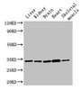 Western Blot, Positive WB detected in: Rat liver tissue, Rat kidney tissue, Mouse brain tissue, Mouse heart tissue, Mouse skeletal muscle tissue, All lanes: AHSA2P antibody at 3ug/ml, Secondary, Goat polyclonal to rabbit IgG at 1/50000 dilution, Predicted band size: 34, 17, 16 kDa, Observed band size: 34 kDa Western Blot, Positive WB detected in: Rat liver tissue, Rat kidney tissue, Mouse brain tissue, Mouse heart tissue, Mouse skeletal muscle tissue, All lanes: AHSA2P antibody at 3ug/ml, Secondary, Goat polyclonal to rabbit IgG at 1/50000 dilution, Predicted band size: 34, 17, 16 kDa, Observed band size: 34 kDa