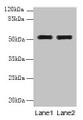 Western Blot, All lanes: WDR88 antibody at 6ug/ml, Lane 1: MCF-7 whole cell lysate, Lane 2: A549 whole cell lysate, Secondary, Goat polyclonal to rabbit IgG at 1/10000 dilution, Predicted band size: 53, 48 kDa, Observed band size: 53 kDa Western Blot, All lanes: WDR88 antibody at 6ug/ml, Lane 1: MCF-7 whole cell lysate, Lane 2: A549 whole cell lysate, Secondary, Goat polyclonal to rabbit IgG at 1/10000 dilution, Predicted band size: 53, 48 kDa, Observed band size: 53 kDa