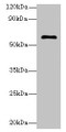 Western Blot, All lanes: GK5 antibody at 4ug/ml + K562 whole cell lysate, Secondary, Goat polyclonal to rabbit IgG at 1/10000 dilution, Predicted band size: 60, 34, 28 kDa, Observed band size: 60 kDa Western Blot, All lanes: GK5 antibody at 4ug/ml + K562 whole cell lysate, Secondary, Goat polyclonal to rabbit IgG at 1/10000 dilution, Predicted band size: 60, 34, 28 kDa, Observed band size: 60 kDa