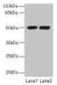 Western Blot, All lanes: TUBA3E antibody at 3ug/ml, Lane 1: MCF-7 whole cell lysate, Lane 2: Hela whole cell lysate, Secondary, Goat polyclonal to rabbit IgG at 1/10000 dilution, Predicted band size: 50 kDa, Observed band size: 50 kDa Western Blot, All lanes: TUBA3E antibody at 3ug/ml, Lane 1: MCF-7 whole cell lysate, Lane 2: Hela whole cell lysate, Secondary, Goat polyclonal to rabbit IgG at 1/10000 dilution, Predicted band size: 50 kDa, Observed band size: 50 kDa