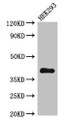 Western Blot, Positive WB detected in: HEK293 whole cell lysate, All lanes: DHRS13 antibody at 4ug/ml, Secondary, Goat polyclonal to rabbit IgG at 1/50000 dilution, Predicted band size: 41, 36, 33 kDa, Observed band size: 41 kDa