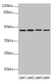 Western Blot, All lanes: NAPEPLD antibody at 6ug/ml, Lane 1: Mouse large intestine tissue, Lane 2: Mouse kidney tissue, Lane 3: Mouse stomach tissue, Lane 4: MCF-7 whole cell lysate, Secondary, Goat polyclonal to rabbit IgG at 1/10000 dilution, Predicted band size: 46 kDa, Observed band size: 46 kDa Western Blot, All lanes: NAPEPLD antibody at 6ug/ml, Lane 1: Mouse large intestine tissue, Lane 2: Mouse kidney tissue, Lane 3: Mouse stomach tissue, Lane 4: MCF-7 whole cell lysate, Secondary, Goat polyclonal to rabbit IgG at 1/10000 dilution, Predicted band size: 46 kDa, Observed band size: 46 kDa