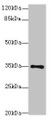 Western Blot, All lanes: MED27 antibody at 0.5ug/ml + A431 whole cell lysate, Secondary, Goat polyclonal to rabbit IgG at 1/10000 dilution, Predicted band size: 36, 32, 15 kDa, Observed band size: 36 kDa Western Blot, All lanes: MED27 antibody at 0.5ug/ml + A431 whole cell lysate, Secondary, Goat polyclonal to rabbit IgG at 1/10000 dilution, Predicted band size: 36, 32, 15 kDa, Observed band size: 36 kDa