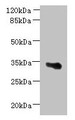 Western Blot, All lanes: ARMCX6 antibody at 1.3ug/ml + U251 whole cell lysate, Secondary, Goat polyclonal to rabbit IgG at 1/10000 dilution, Predicted band size: 34 kDa, Observed band size: 34 kDa