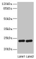 Western Blot, All lanes: RD3 antibody at 0.5ug/ml, Lane 1: Mouse thymus tissue, Lane 2: Human placenta tissue, Secondary, Goat polyclonal to rabbit IgG at 1/10000 dilution, Predicted band size: 23 kDa, Observed band size: 23 kDa Western Blot, All lanes: RD3 antibody at 0.5ug/ml, Lane 1: Mouse thymus tissue, Lane 2: Human placenta tissue, Secondary, Goat polyclonal to rabbit IgG at 1/10000 dilution, Predicted band size: 23 kDa, Observed band size: 23 kDa