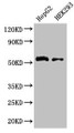 Western Blot, Positive WB detected in: HepG2 whole cell lysate, HEK293 whole cell lysate, All lanes: LDHD antibody at 3.2ug/ml, Secondary, Goat polyclonal to rabbit IgG at 1/50000 dilution, Predicted band size: 55, 53 kDa, Observed band size: 55 kDa Western Blot, Positive WB detected in: HepG2 whole cell lysate, HEK293 whole cell lysate, All lanes: LDHD antibody at 3.2ug/ml, Secondary, Goat polyclonal to rabbit IgG at 1/50000 dilution, Predicted band size: 55, 53 kDa, Observed band size: 55 kDa