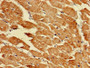 Immunohistochemistry of paraffin-embedded human heart tissue using CAC14263 at dilution of 1:100 Immunohistochemistry of paraffin-embedded human heart tissue using CAC14263 at dilution of 1:100