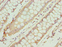 Immunohistochemistry of paraffin-embedded human colon cancer using CAC14264 at dilution of 1:100