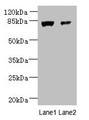 Western Blot, All lanes: WDR49 antibody at 7ug/ml, Lane 1: A549 whole cell lysate, Lane 2: Hela whole cell lysate, Secondary, Goat polyclonal to rabbit IgG at 1/10000 dilution, Predicted band size: 80, 60 kDa, Observed band size: 80 kDa