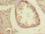 Immunohistochemistry of paraffin-embedded human testis tissue using CAC14280 at dilution of 1:100