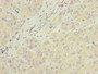 Immunohistochemistry of paraffin-embedded human liver cancer using CAC14286 at dilution of 1:100