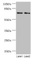 Western Blot, All lanes: MAGEC3 antibody at 2ug/ml, Lane 1: A375 whole cell lysate, Lane 2: Rat thymus tissue, Secondary, Goat polyclonal to rabbit IgG at 1/10000 dilution, Predicted band size: 72, 39 kDa, Observed band size: 72 kDa