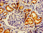 IHC image of CAC14290 diluted at 1:600 and staining in paraffin-embedded human kidney tissue performed on a Leica BondTM system. After dewaxing and hydration, antigen retrieval was mediated by high pressure in a citrate buffer (pH 6.0). Section was blocked with 10% normal goat serum 30min at RT. Then primary antibody (1% BSA) was incubated at 4°C overnight. The primary is detected by a biotinylated secondary antibody and visualized using an HRP conjugated SP system. IHC image of CAC14290 diluted at 1:600 and staining in paraffin-embedded human kidney tissue performed on a Leica BondTM system. After dewaxing and hydration, antigen retrieval was mediated by high pressure in a citrate buffer (pH 6.0). Section was blocked with 10% normal goat serum 30min at RT. Then primary antibody (1% BSA) was incubated at 4°C overnight. The primary is detected by a biotinylated secondary antibody and visualized using an HRP conjugated SP system.