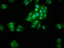 Immunofluorescence staining of HepG2 cells with CAC14290 at 1:200, counter-stained with DAPI. The cells were fixed in 4% formaldehyde, permeabilized using 0.2% Triton X-100 and blocked in 10% normal Goat Serum. The cells were then incubated with the antibody overnight at 4°C. The secondary antibody was Alexa Fluor 488-congugated AffiniPure Goat Anti-Rabbit IgG(H+L). Immunofluorescence staining of HepG2 cells with CAC14290 at 1:200, counter-stained with DAPI. The cells were fixed in 4% formaldehyde, permeabilized using 0.2% Triton X-100 and blocked in 10% normal Goat Serum. The cells were then incubated with the antibody overnight at 4°C. The secondary antibody was Alexa Fluor 488-congugated AffiniPure Goat Anti-Rabbit IgG(H+L).