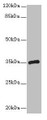 Western Blot, All lanes: CPXCR1 antibody at 5ug/ml + Mouse brain tissue, Secondary, Goat polyclonal to rabbit IgG at 1/10000 dilution, Predicted band size: 35 kDa, Observed band size: 35 kDa Western Blot, All lanes: CPXCR1 antibody at 5ug/ml + Mouse brain tissue, Secondary, Goat polyclonal to rabbit IgG at 1/10000 dilution, Predicted band size: 35 kDa, Observed band size: 35 kDa