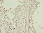 Immunohistochemistry of paraffin-embedded human testis tissue using CAC14299 at dilution of 1:100 Immunohistochemistry of paraffin-embedded human testis tissue using CAC14299 at dilution of 1:100