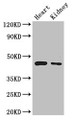 Western Blot, Positive WB detected in: Mouse heart tissue, Mouse kidney tissue, All lanes: PTCD2 antibody at 2.7ug/ml, Secondary, Goat polyclonal to rabbit IgG at 1/50000 dilution, Predicted band size: 44, 25, 31 kDa, Observed band size: 44 kDa