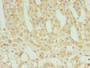 Immunohistochemistry of paraffin-embedded human adrenal gland tissue using CAC14303 at dilution of 1:100 Immunohistochemistry of paraffin-embedded human adrenal gland tissue using CAC14303 at dilution of 1:100