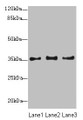 Western Blot, All lanes: NUP35 antibody at 12ug/ml, Lane 1: Jurkat whole cell lysate, Lane 2: A431 whole cell lysate, Lane 3: HepG2 whole cell lysate, Secondary, Goat polyclonal to rabbit IgG at 1/10000 dilution, Predicted band size: 35, 34, 22 kDa, Observed band size: 35 kDa Western Blot, All lanes: NUP35 antibody at 12ug/ml, Lane 1: Jurkat whole cell lysate, Lane 2: A431 whole cell lysate, Lane 3: HepG2 whole cell lysate, Secondary, Goat polyclonal to rabbit IgG at 1/10000 dilution, Predicted band size: 35, 34, 22 kDa, Observed band size: 35 kDa